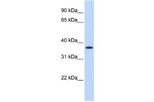 Western Blotting (WB) image for anti-Methylenetetrahydrofolate Dehydrogenase (NADP+ Dependent) 2, Methenyltetrahydrofolate Cyclohydrolase (MTHFD2) antibody (ABIN2458979)