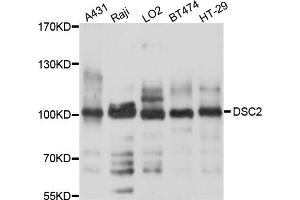 Western blot analysis of extracts of various cell lines, using DSC2 antibody (ABIN4903516) at 1:1000 dilution.