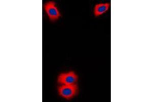 Immunofluorescent analysis of Cytochrome P450 11A1 staining in Jurkat cells. (CYP11A1 antibody  (C-Term))