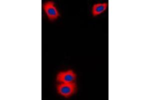Immunofluorescent analysis of Cytochrome P450 11A1 staining in Jurkat cells. (CYP11A1 antibody  (C-Term))