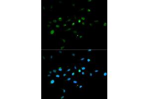 Immunofluorescence analysis of A549 cell using TRIM63 antibody.