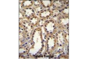 GPC6 Antibody (C-term) (ABIN655620 and ABIN2845100) immunohistochemistry analysis in formalin fixed and paraffin embedded human kidney tissue followed by peroxidase conjugation of the secondary antibody and DAB staining. (Glypican 6 antibody  (C-Term))