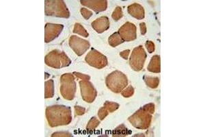 Immunohistochemistry (IHC) image for anti-Angiopoietin-Like 4 (ANGPTL4) antibody (ABIN3004083) (ANGPTL4 antibody)