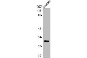 Western Blot analysis of HuvEc cells using ABHD11 Polyclonal Antibody (ABHD11 antibody  (Internal Region))