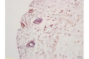 Formalin-fixed and paraffin embedded mouse embryo labeled with Anti-Hes5 Polyclonal Antibody, Unconjugated (ABIN703811) at 1:200 followed by conjugation to the secondary antibody and DAB staining (HES5 antibody  (AA 21-120))
