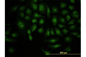 Immunofluorescence of monoclonal antibody to DCP1A on HeLa cell. (DCP1A antibody  (AA 186-285))