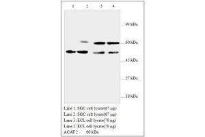 Image no. 1 for anti-Acetyl-CoA Acetyltransferase 2 (ACAT2) antibody (ABIN791348) (ACAT2 antibody)