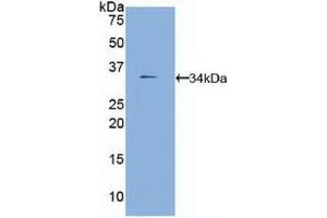 FUCA1 anticorps  (AA 185-447)