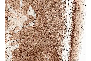 Immunohistochemistry analysis using Rabbit Anti-CCR2 Polyclonal Antibody (ABIN5066707). (CCR2 antibody  (FITC))