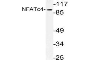 Western blot (WB) analysis of NFATc4 antibody in extracts from 293 cells. (NFATC4 antibody)