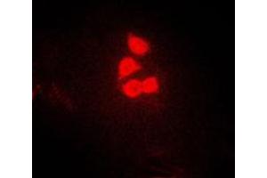 Immunofluorescent analysis of YAP1 staining in HeLa cells. (YAP1 antibody  (Center))