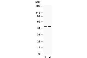 Western blot testing of human 1) HeLa and 2) A549 cell lysate with ING1 antibody. (ING1 antibody)