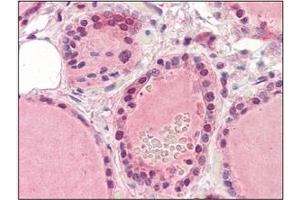 Immunohistochemistry (IHC) image for anti-EPH Receptor A2 (EPHA2) (AA 559-976) antibody (ABIN317513) (EPH Receptor A2 antibody  (AA 559-976))