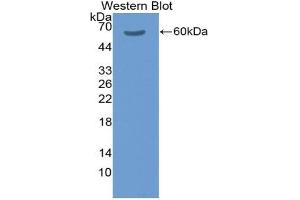 Western blot analysis of the recombinant protein. (Factor XI antibody  (AA 275-516))