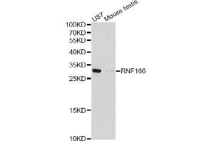 Western blot analysis of extracts of various cell lines, using RNF166 antibody (ABIN4905019) at 1:1000 dilution. (RNF166 antibody)