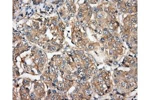 Image no. 4 for anti-Bruton Agammaglobulinemia tyrosine Kinase (BTK) antibody (ABIN1496974) (BTK antibody)