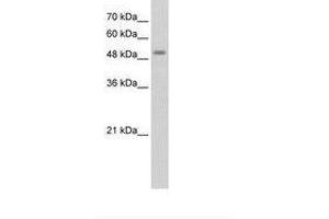 Image no. 2 for anti-serine/threonine Kinase 11 (STK11) (AA 71-120) antibody (ABIN203483)