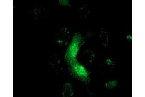 Anti-MRAS mouse monoclonal antibody (ABIN2454547) immunofluorescent staining of COS7 cells transiently transfected by pCMV6-ENTRY MRAS (RC212259). (MRAS antibody)
