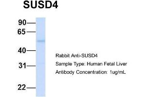 Host:  Rabbit  Target Name:  SUSD4  Sample Type:  Human Fetal Liver  Antibody Dilution:  1. (SUSD4 antibody  (N-Term))