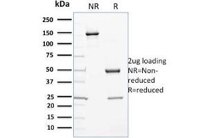 SDS-PAGE Analysis Purified Cytochrome P450 1A1/1A2 Mouse Monoclonal Antibody (P6). (CYP3A1 antibody)