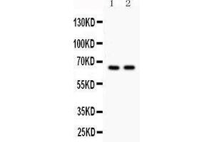 Anti- Cdc25B Picoband antibody, Western blotting All lanes: Anti Cdc25B  at 0.