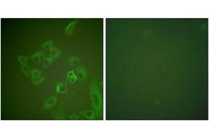 Immunofluorescence analysis of A549 cells, using Synuclein beta Antibody. (beta Synuclein antibody  (AA 85-134))