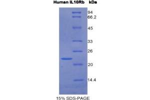 SDS-PAGE analysis of Human IL10Rb Protein. (IL10RB Protein)