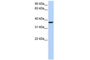 Image no. 1 for anti-High Mobility Group 20B (HMG20B) (AA 201-250) antibody (ABIN6742602) (HMG20B antibody  (AA 201-250))