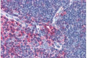 Anti-MSN / Moesin antibody IHC of human thymus. (Moesin antibody)