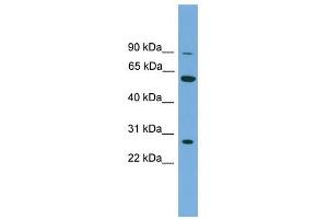 IMPDH2 antibody used at 1 ug/ml to detect target protein.