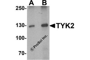 Western Blotting (WB) image for anti-Tyrosine Kinase 2 (TYK2) (N-Term) antibody (ABIN1077422) (TYK2 antibody  (N-Term))