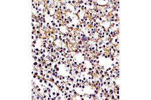 (ABIN654625 and ABIN2844322) staining D11b in human tonsil tissue sections by Immunohistochemistry (IHC-P - paraformaldehyde-fixed, paraffin-embedded sections). (CD11b antibody  (N-Term))