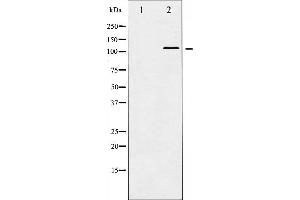 Western blot analysis of HDAC5 phosphorylation expression in NIH-3T3 whole cell lysates,The lane on the left is treated with the antigen-specific peptide. (HDAC5 antibody  (pSer498))