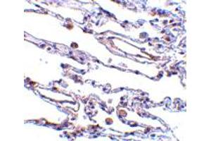 Immunohistochemistry of TRAF3IP2 in human lung tissue with TRAF3IP2 polyclonal antibody  at 5 ug/mL .