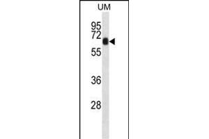 CCD Antibody (N-term) (ABIN657286 and ABIN2846373) western blot analysis in uterus tumor cell line lysates (35 μg/lane).