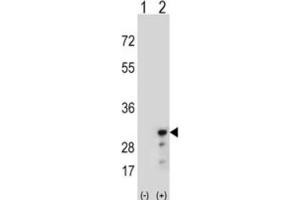Western Blotting (WB) image for anti-Peroxiredoxin 3 (PRDX3) antibody (ABIN3001722) (Peroxiredoxin 3 antibody)