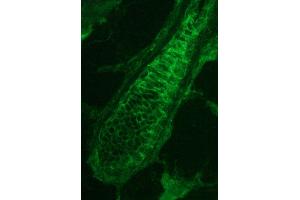 Image no. 1 for anti-Plakophilin 3 (PKP3) antibody (ABIN335358) (Plakophilin 3 antibody)