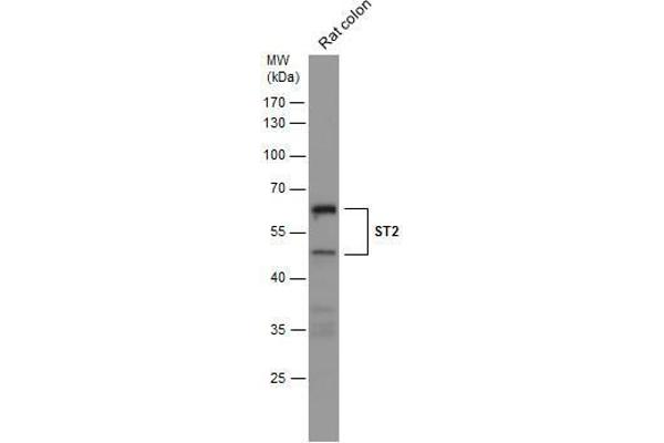 IL1RL1 antibody