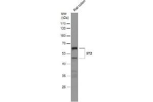 WB Image Rat tissue extract (50 μg) was separated by 10% SDS-PAGE, and the membrane was blotted with ST2 antibody [N1C1] , diluted at 1:500. (IL1RL1 antibody)