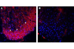 Expression of TrkB in rat spinal cord.