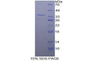 SDS-PAGE (SDS) image for Nucleoporin 98kDa (NUP98) (AA 629-894) protein (His tag) (ABIN2126171)