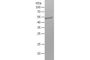 Western Blotting (WB) image for Adaptor-Related Protein Complex 2, alpha 1 Subunit (AP2A1) (AA 601-747) protein (His-IF2DI Tag) (ABIN7282636) (alpha Adaptin Protein (AA 601-747) (His-IF2DI Tag))