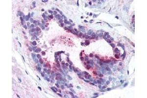 Image no. 1 for anti-Programmed Cell Death 4 (PDCD4) (pSer457), (Ser457) antibody (ABIN401369) (PDCD4 antibody  (pSer457, Ser457))