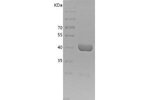 Western Blotting (WB) image for Plasminogen Activator Inhibitor 1 (SERPINE1) (AA 23-402) protein (His tag) (ABIN7281659) (PAI1 Protein (AA 23-402) (His tag))