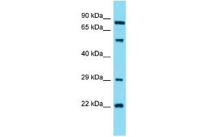 Western Blotting (WB) image for anti-Guanylate Cyclase 1, Soluble, alpha 2 (GUCY1A2) (N-Term) antibody (ABIN2438197) (GUCY1A2 antibody  (N-Term))