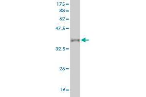 Western Blot detection against Immunogen (37. (PGA5 antibody  (AA 203-306))