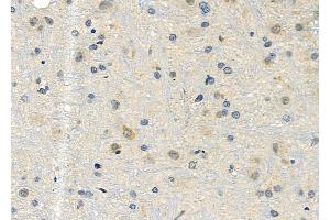 ABIN6257219 and ABIN6276016 at 1/100 staining Rat brain tissue by IHC-P. (GPR153 antibody  (Internal Region))