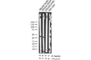 Western Blotting (WB) image for anti-Eukaryotic Translation Initiation Factor 2 Subunit 1 (EIF2S1) (pSer51) antibody (ABIN6255389)