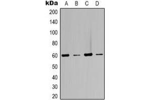 Western blot analysis of Beclin-1 expression in Jurkat (A), 293T (B), C2C12 (C), rat kidney (D) whole cell lysates. (Beclin 1 antibody)
