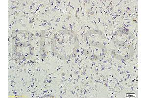 GREM1 antibody  (AA 101-184)